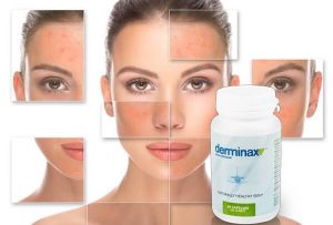 Derminax – Cerchi un rimedio efficace per l’acne?