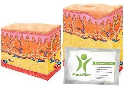 ProstaPlast-struttura-della-pelle