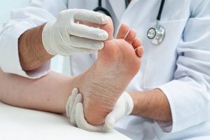 Infezione fungina ai piedi – Sintomi e trattamento