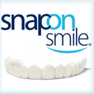 Snap-On Smile faccette dentali Recensioni Italia