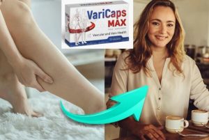 VariCaps Max – per contrastare vene varicose e capillari?