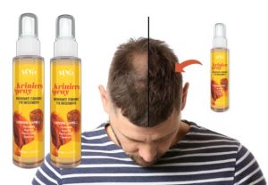 Kriniera Spray Recensioni – Questa lozione può davvero contrastare la caduta dei capelli?